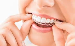 الواقي الليلي Dr Mansour Dental Practice
